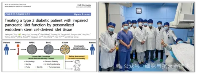 干細(xì)胞來源的自體再生胰島移植