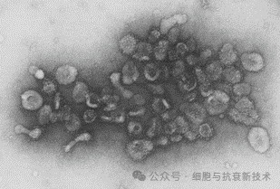 1983年第一次發(fā)現(xiàn)外泌體的存在